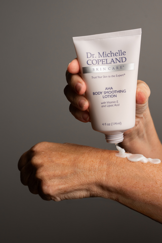 Dr. Michelle Copeland AHA Body Smoothing Lotion with 16% Alpha-Hydroxy Acid for Rough Skin, Calluses, & Stretch Marks
