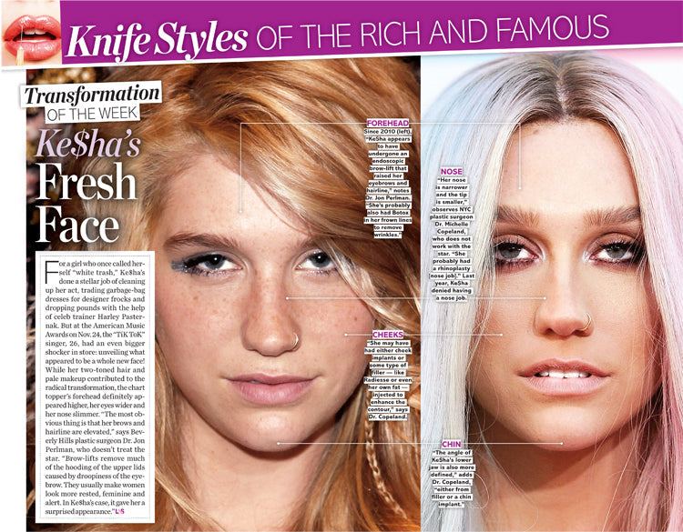 Ke$ha’s Fresh Face