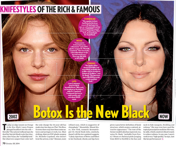 Botox is the New Black
