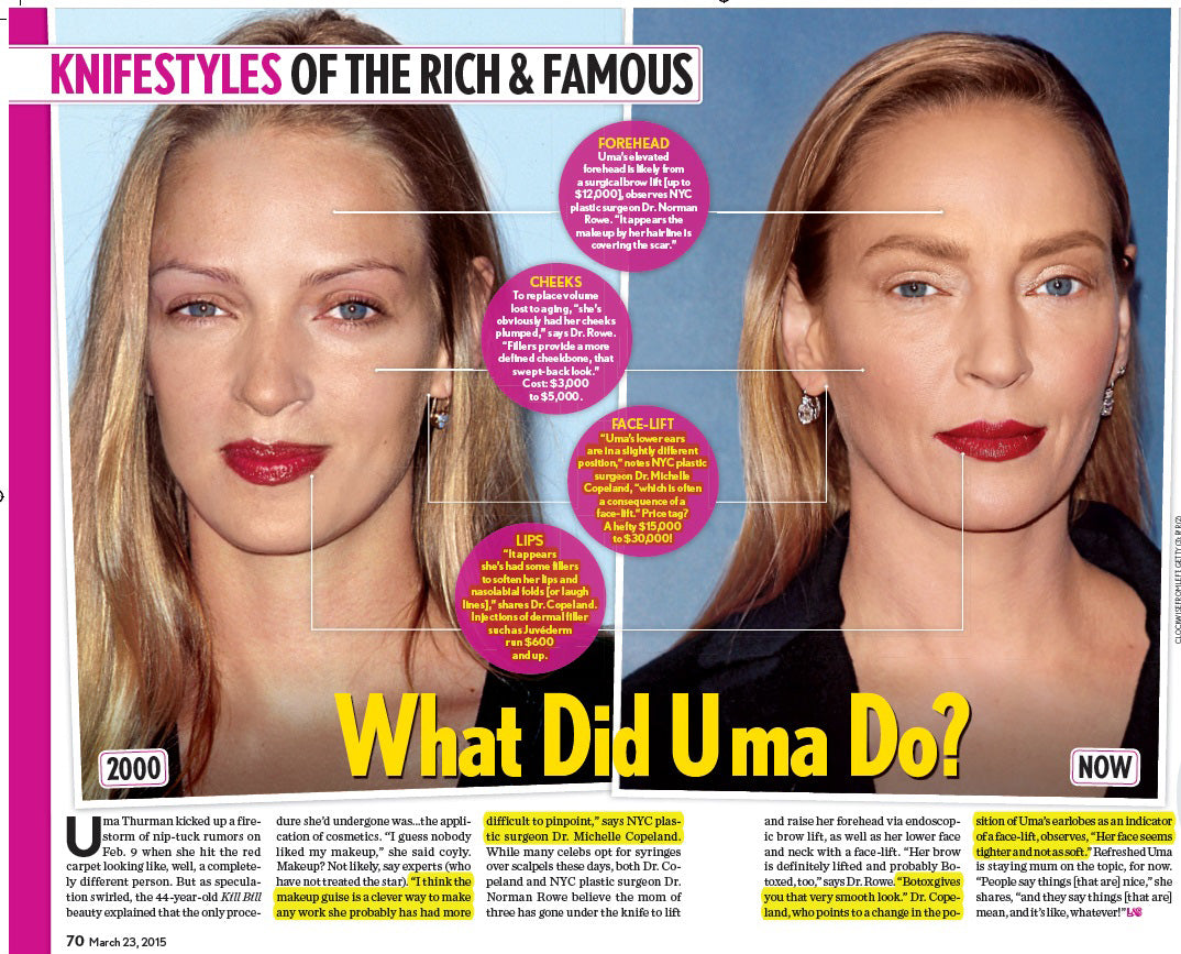 What Did Uma Do